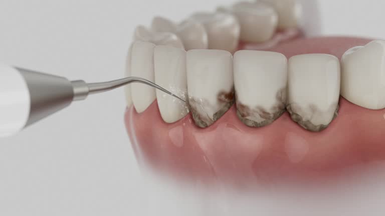 Trusted Dental Implants service in Altamonte Springs, FL - Dentist Open Now